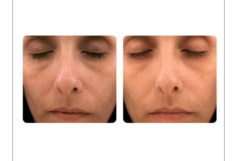 Anti-Aging Treatments