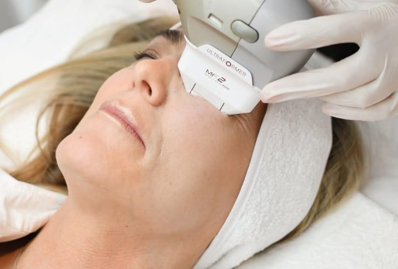 Skin Tightening