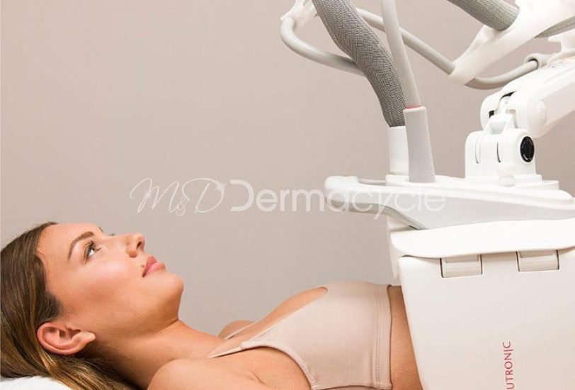 Body Contouring