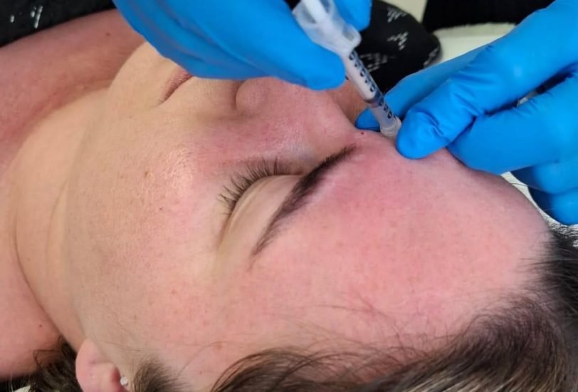 Anti-Aging Treatments