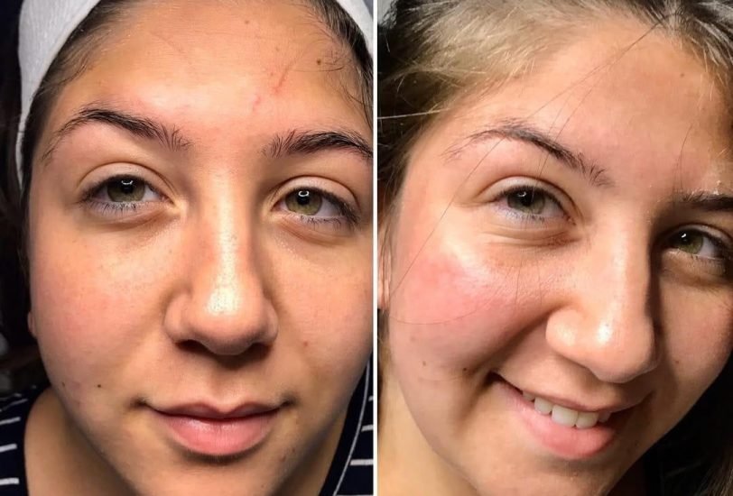 Anti-Aging Treatments