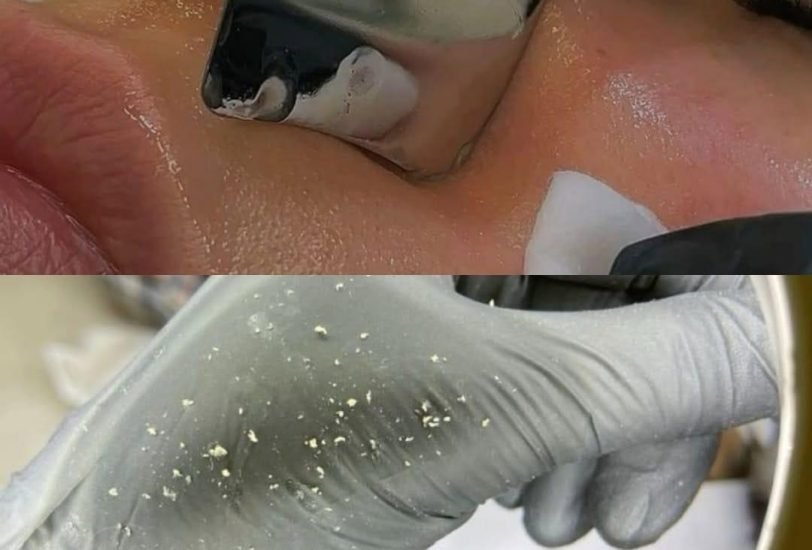 Pore & Texture Refinement