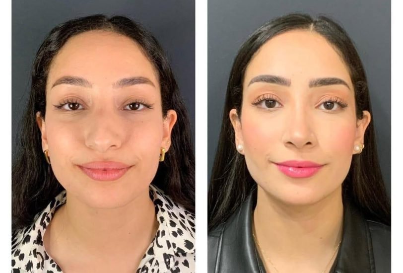 Injectable Treatments