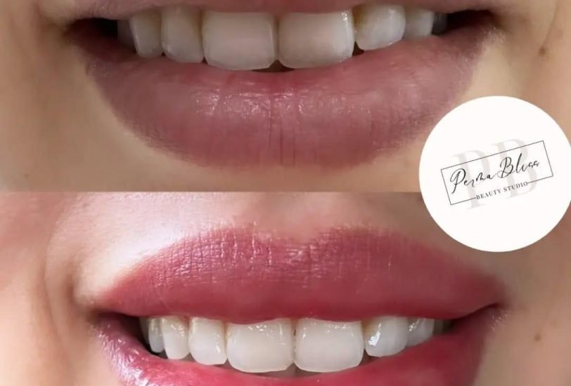 Lips Treatments