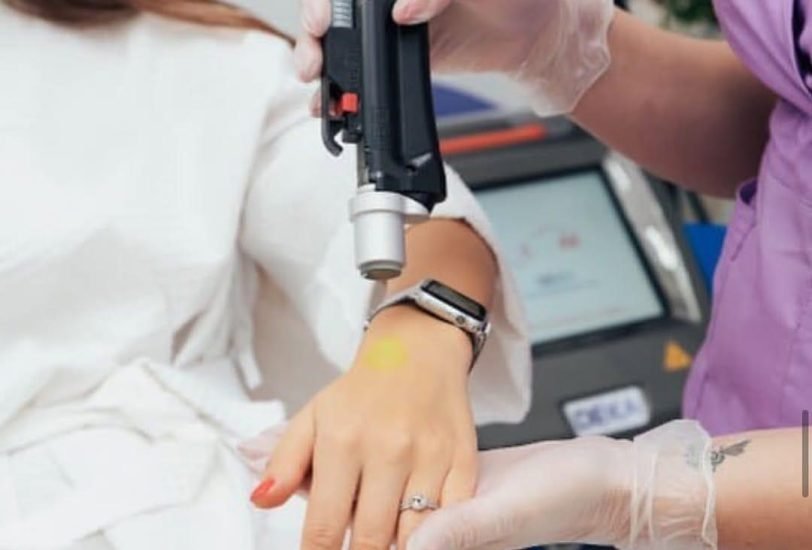 Laser Hair Removal