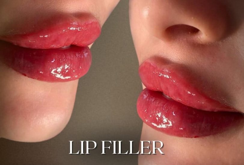 Lips Treatments