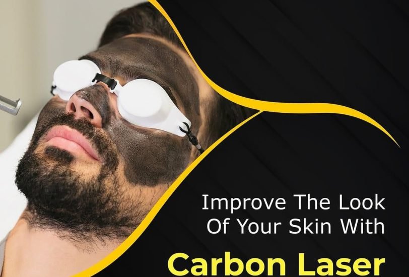 Laser Hair Removal