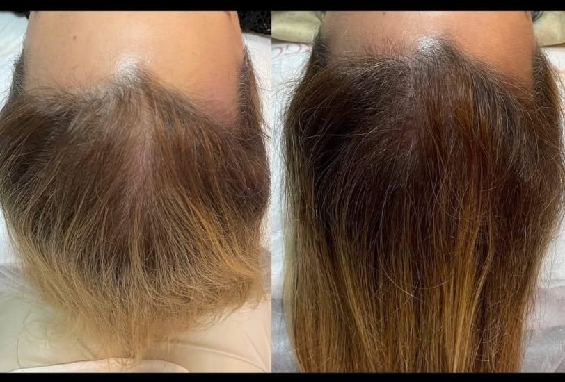 Hair Treatments