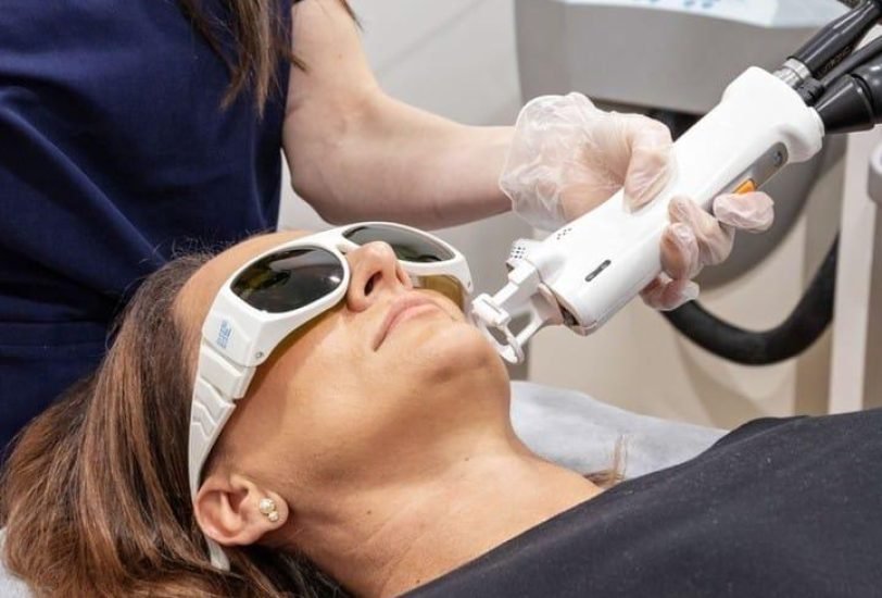 Laser Hair Removal