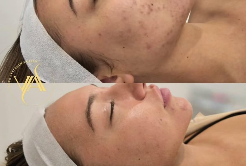 Your Aesthetics Clinic 3 – VerifiedCare Dermatology