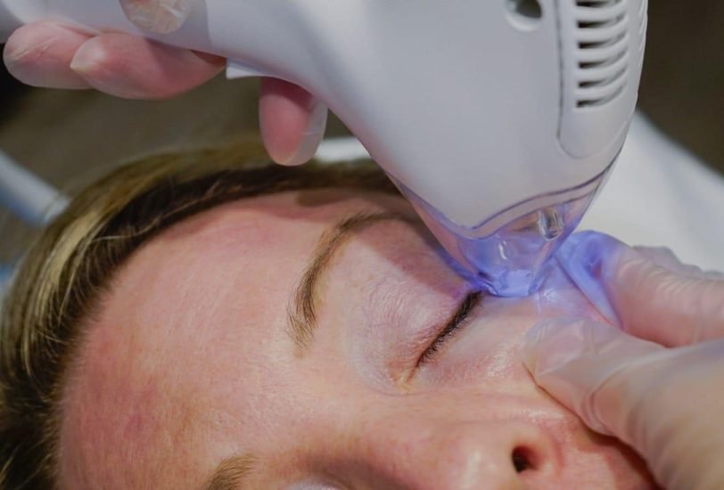 Facial Contouring & Lifting