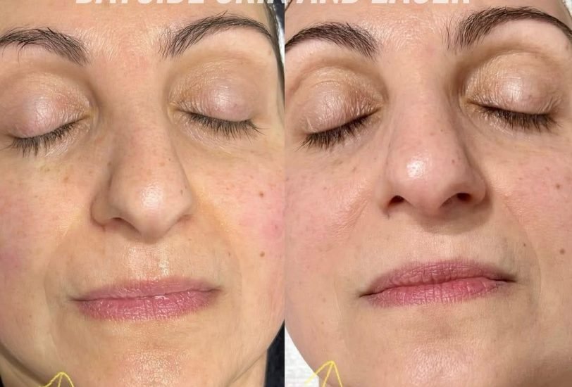 Anti-Aging Treatments