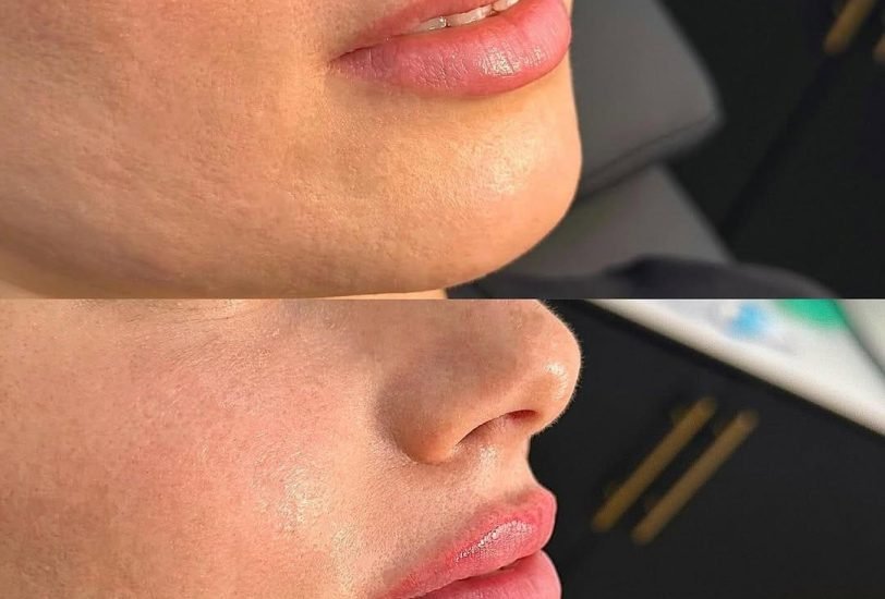 injectable Treatments