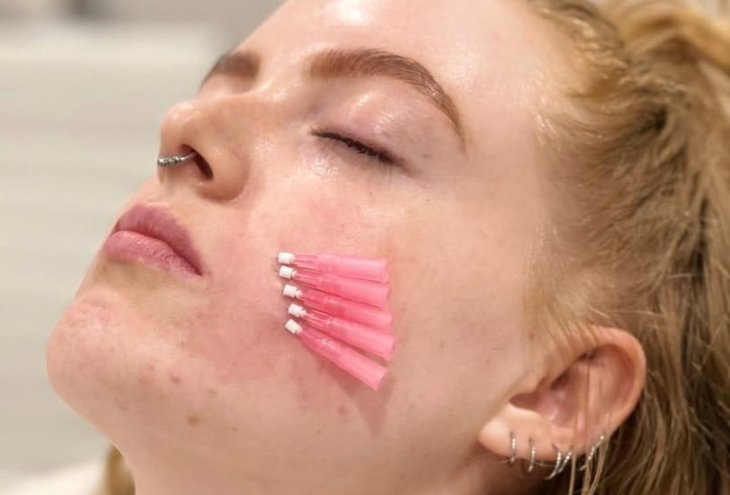 Anti-Aging Treatments
