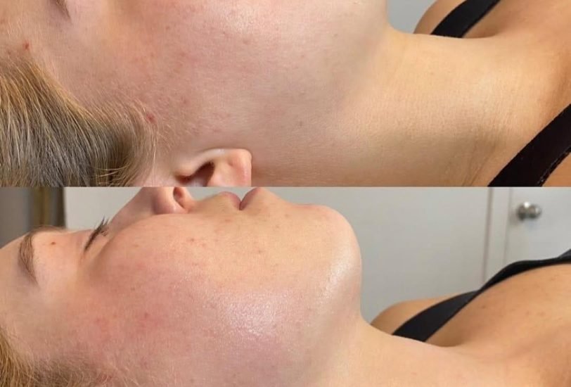 Injectable Treatments