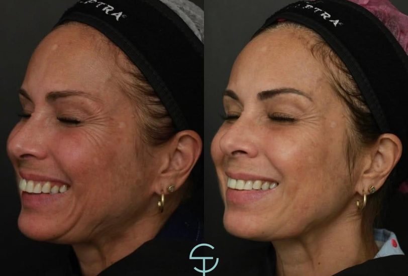 Anti-Aging Treatments
