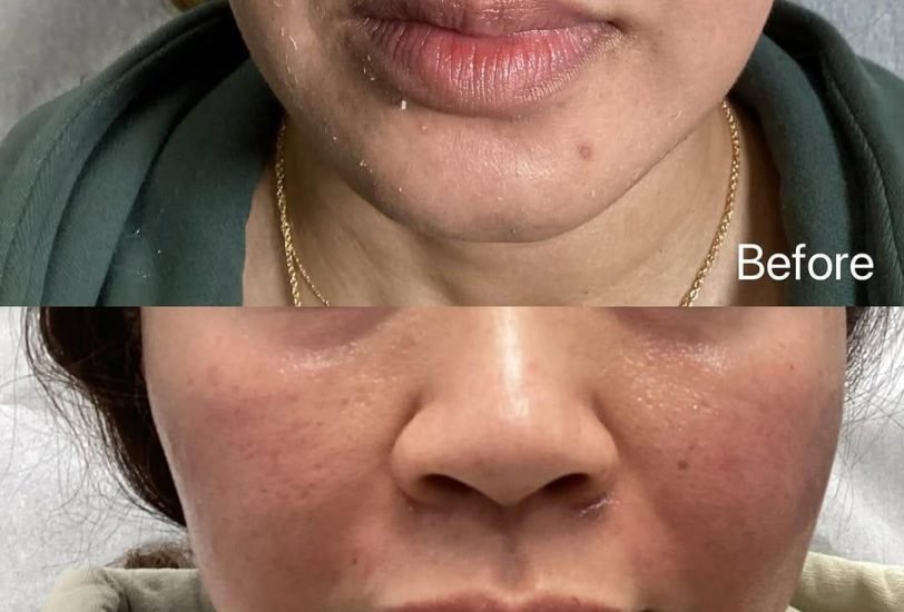 Anti-Aging Treatments