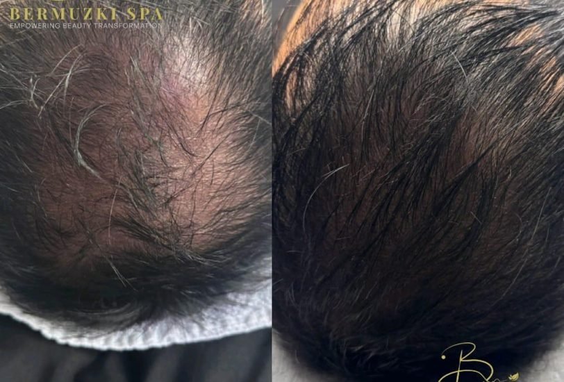 Hair Treatments