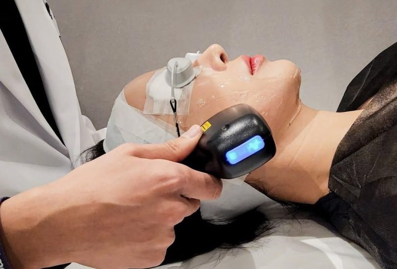 Skin Tightening