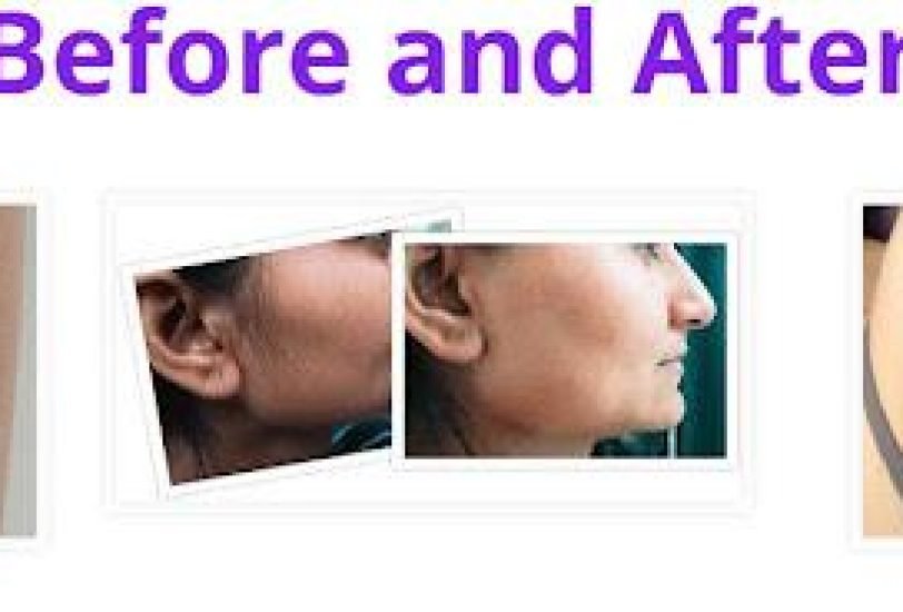 Pigmentation & Skin Tone Correction