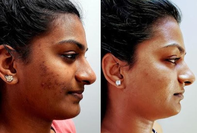 Anti-Aging Treatments